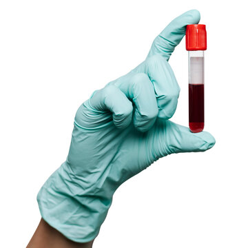 Exame de dna paternidade